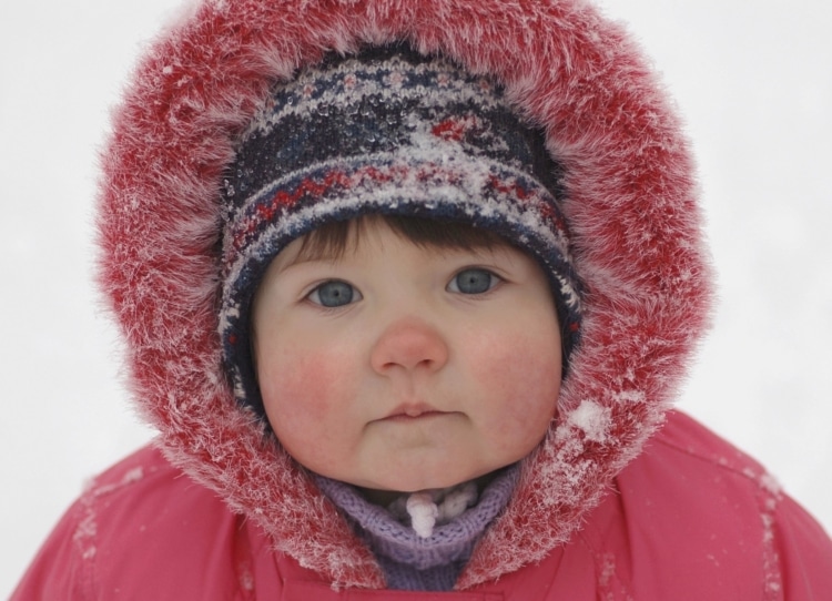 Чем лечить обморожение щек у ребенка thumbnail
